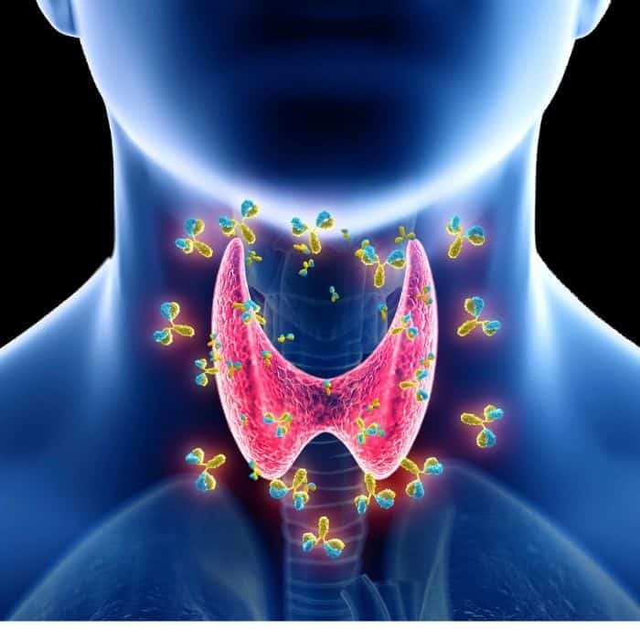 gut health and hashimoto's thyroiditis