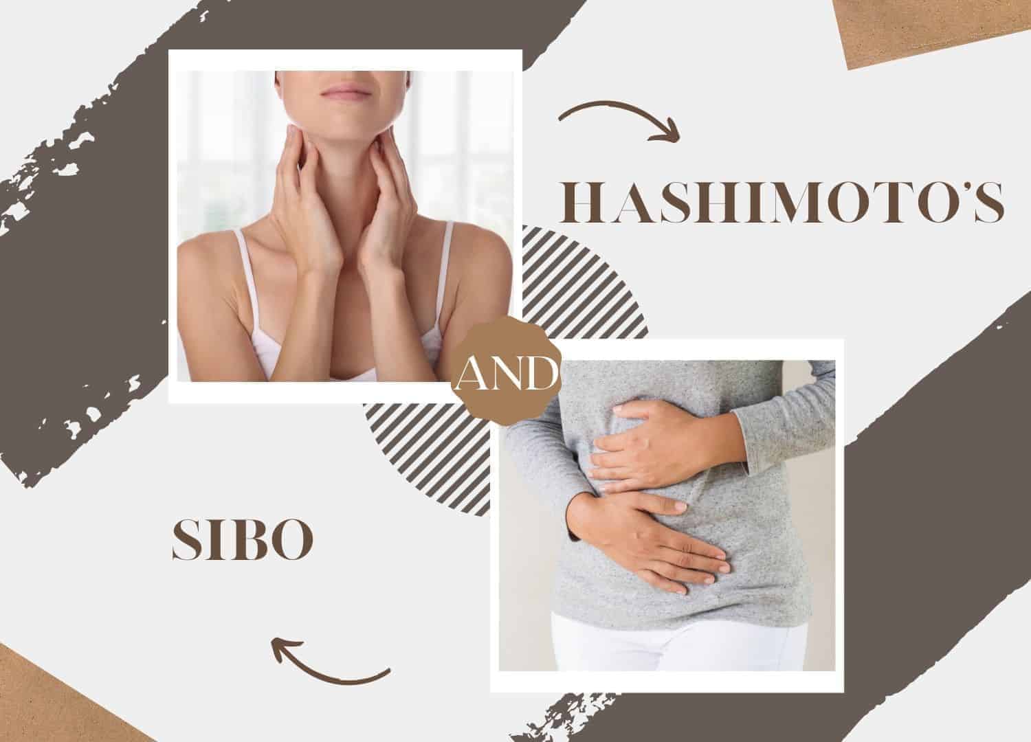 Relationship Between SIBO and Hashimoto’s
